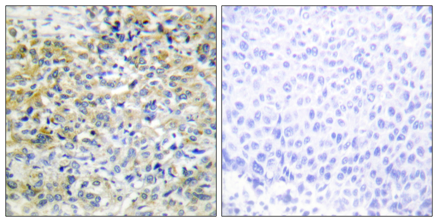 CARKL Rabbit Polyclonal Antibody