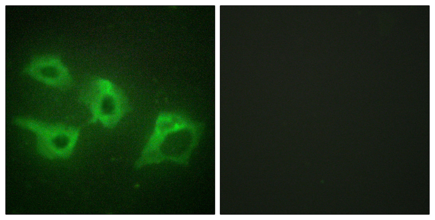 Casein Kinase Iα Rabbit Polyclonal Antibody