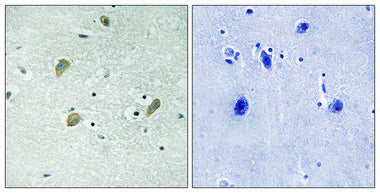 Casein Kinase Iγ1/2/3 Rabbit Polyclonal Antibody