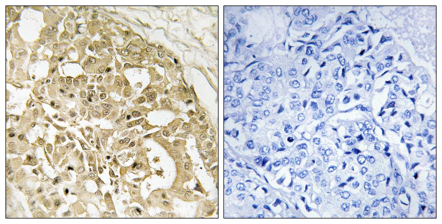 Catenin-β Rabbit Polyclonal Antibody