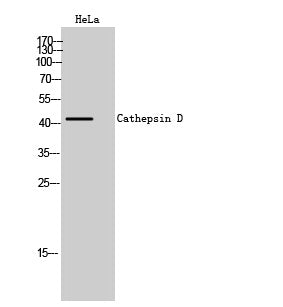 Cathepsin D Rabbit Polyclonal Antibody
