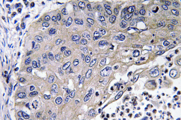 Cathepsin D Rabbit Polyclonal Antibody