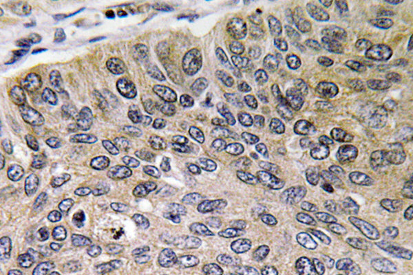 Cathepsin E Rabbit Polyclonal Antibody