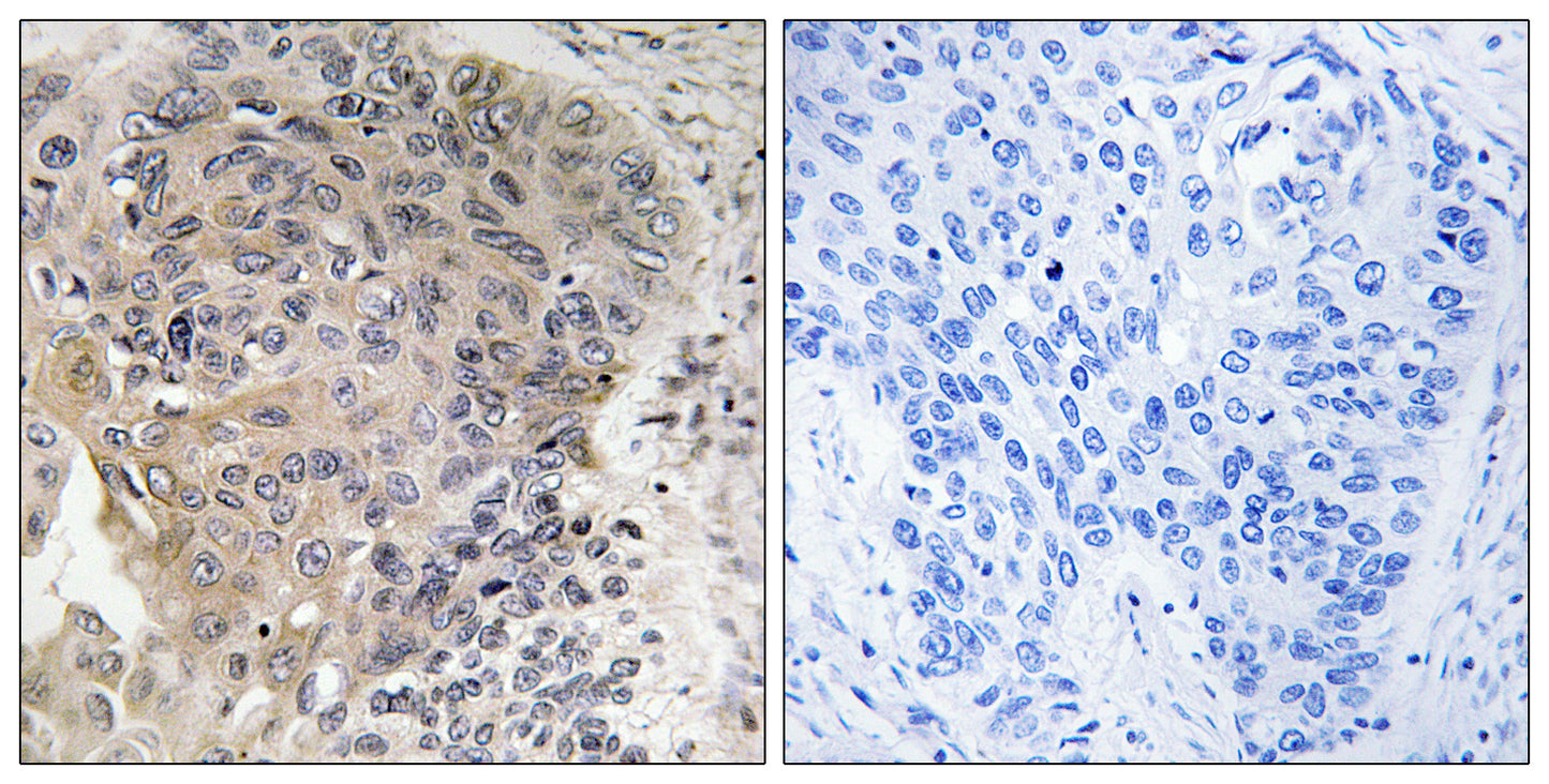CCP3 Rabbit Polyclonal Antibody