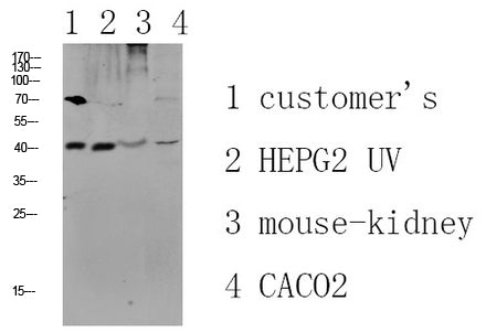 CCR5 Rabbit Polyclonal Antibody