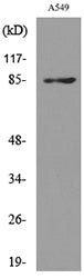 CD10 Rabbit Polyclonal Antibody