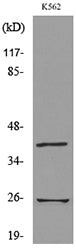 CD161 Rabbit Polyclonal Antibody