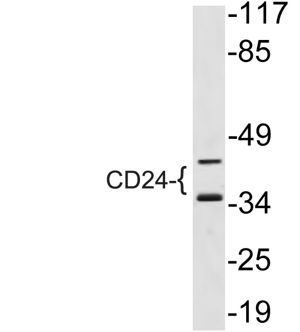 CD24 Rabbit Polyclonal Antibody