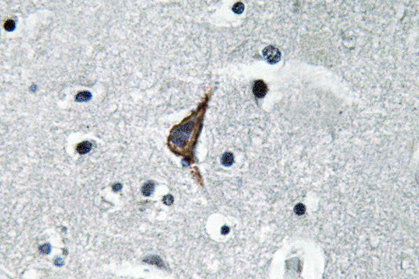CD284 Rabbit Polyclonal Antibody