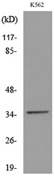 CD32-A Rabbit Polyclonal Antibody