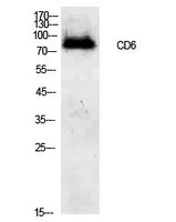 CD6 Rabbit Polyclonal Antibody