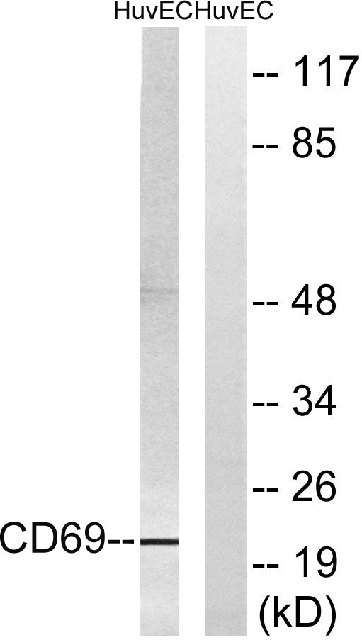 CD69 Rabbit Polyclonal Antibody