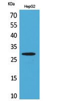 CD69 Rabbit Polyclonal Antibody