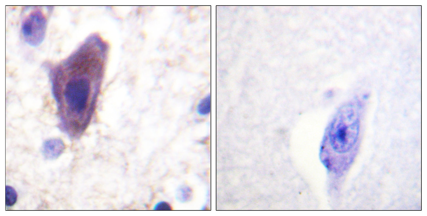 CD71 Rabbit Polyclonal Antibody