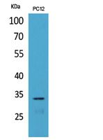 CD74 Rabbit Polyclonal Antibody