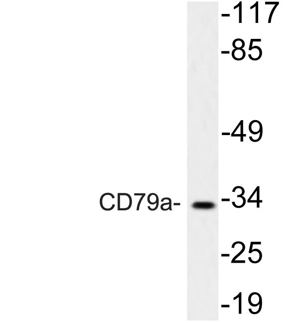 CD79a Rabbit Polyclonal Antibody