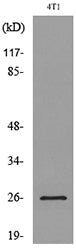 CD81 Rabbit Polyclonal Antibody