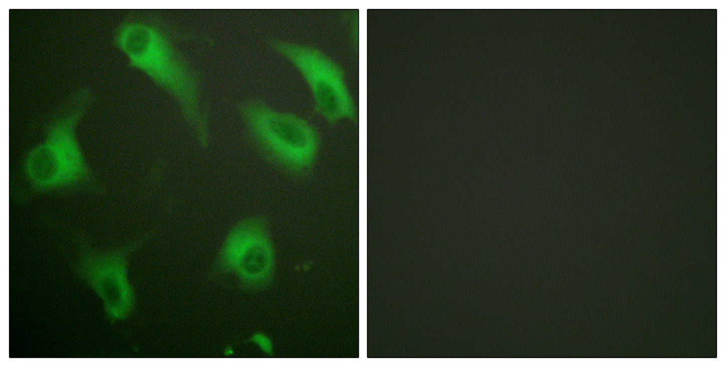 CD88 Rabbit Polyclonal Antibody