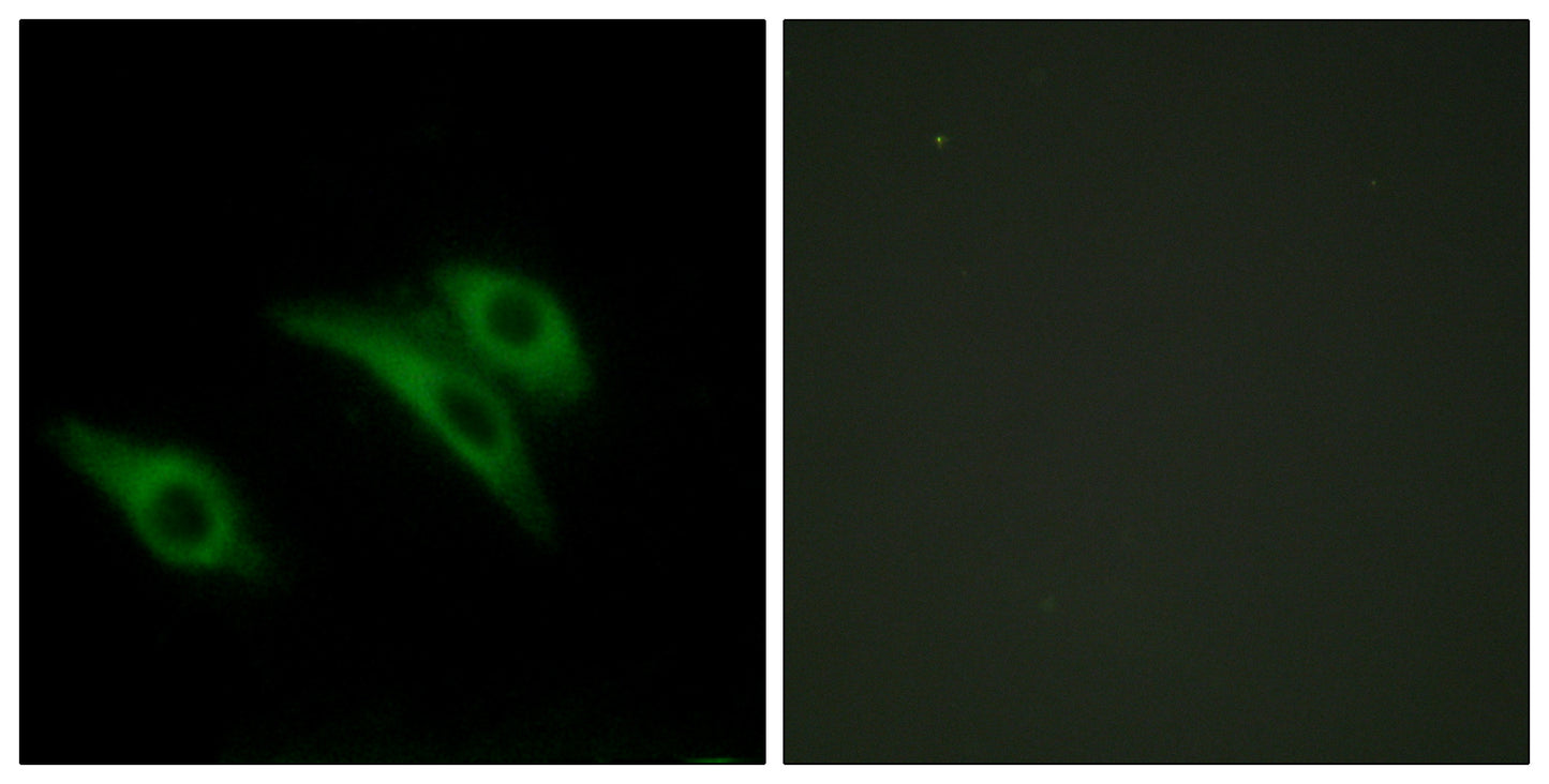 CD9 Rabbit Polyclonal Antibody