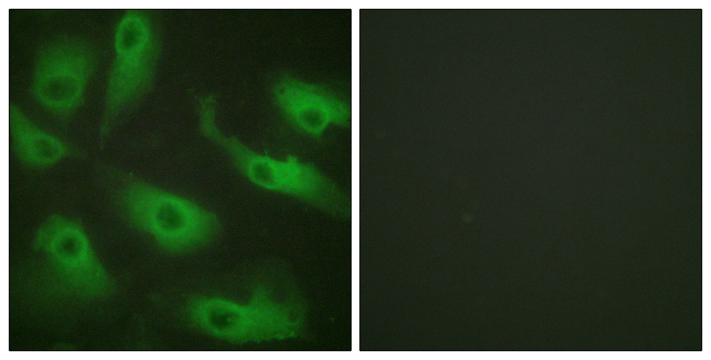 Cdc37 Rabbit Polyclonal Antibody