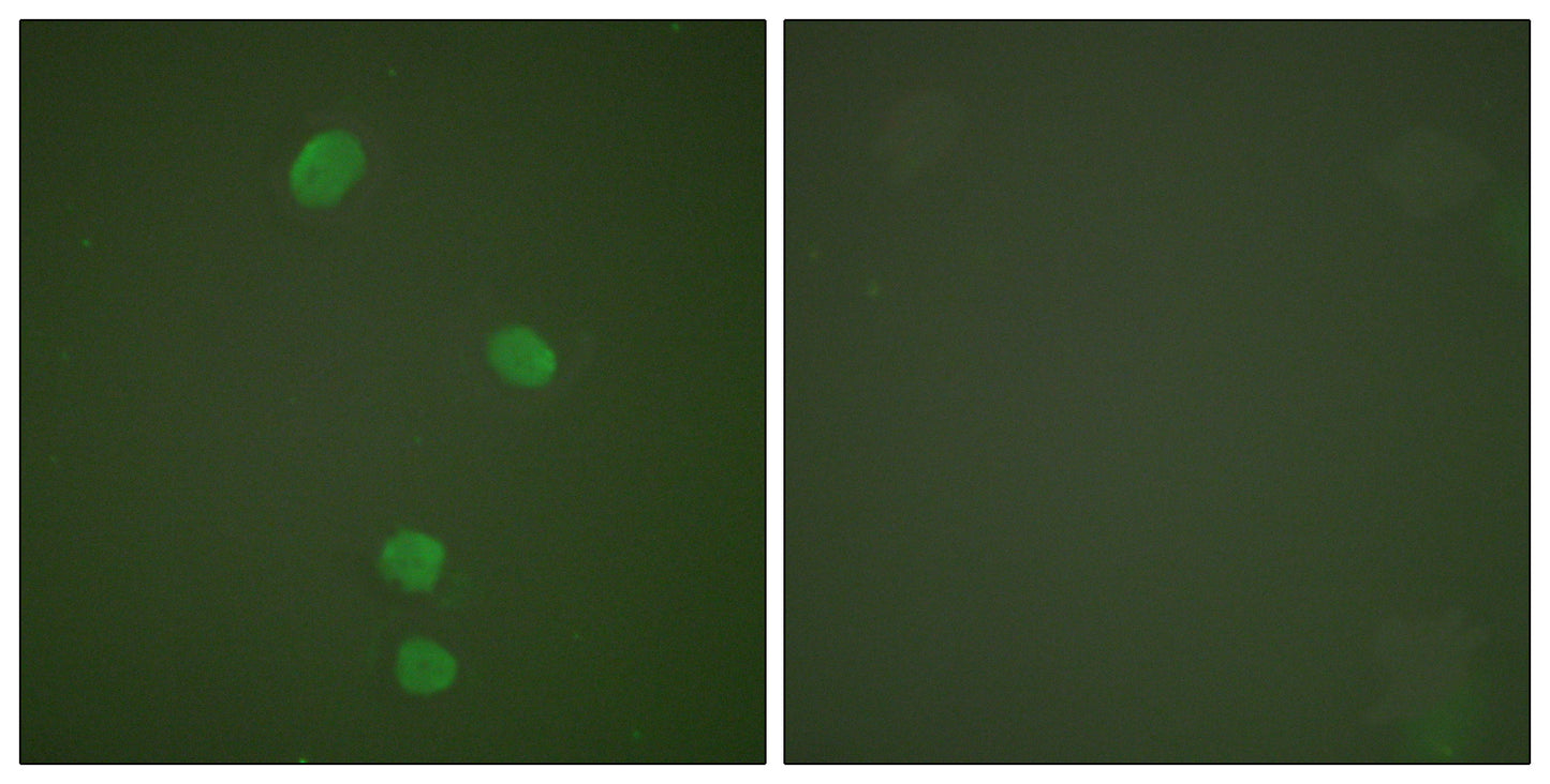 CDC46 Rabbit Polyclonal Antibody