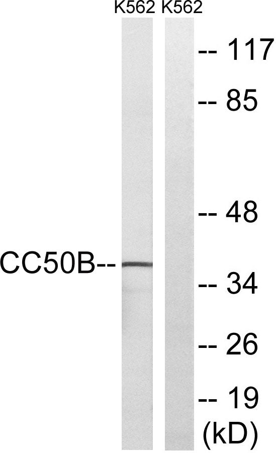 Cdc50B Rabbit Polyclonal Antibody