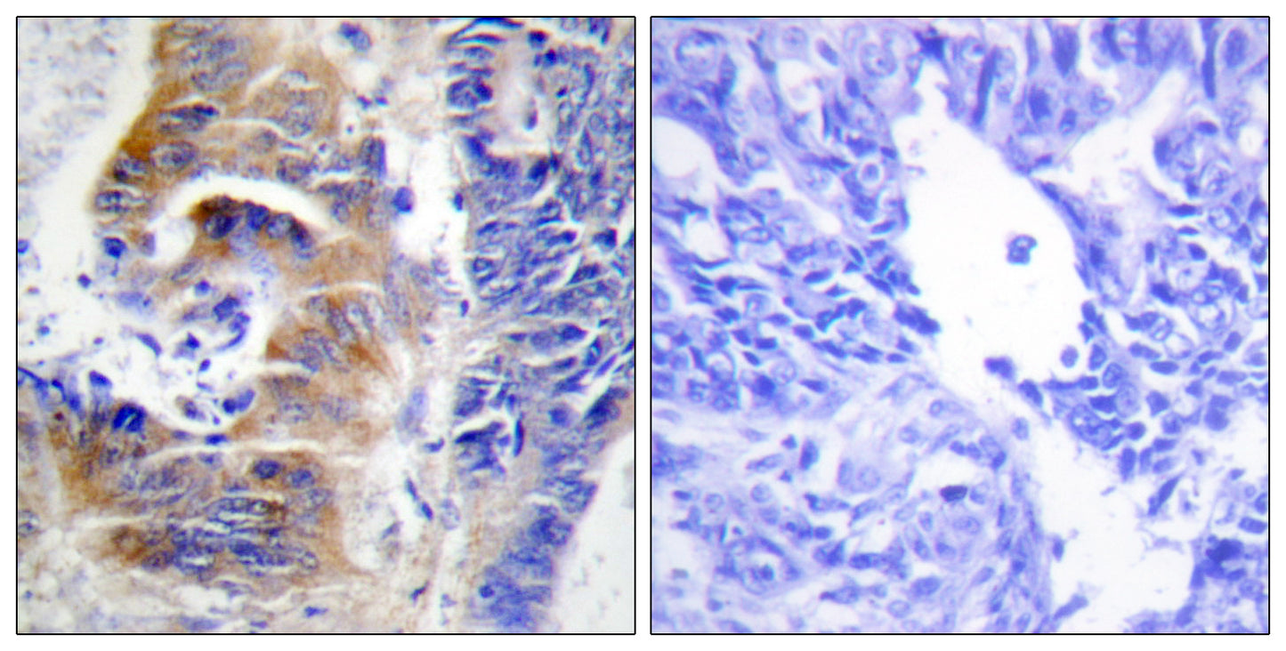 CdcA3 Rabbit Polyclonal Antibody