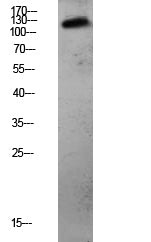 CDH3 Rabbit Polyclonal Antibody
