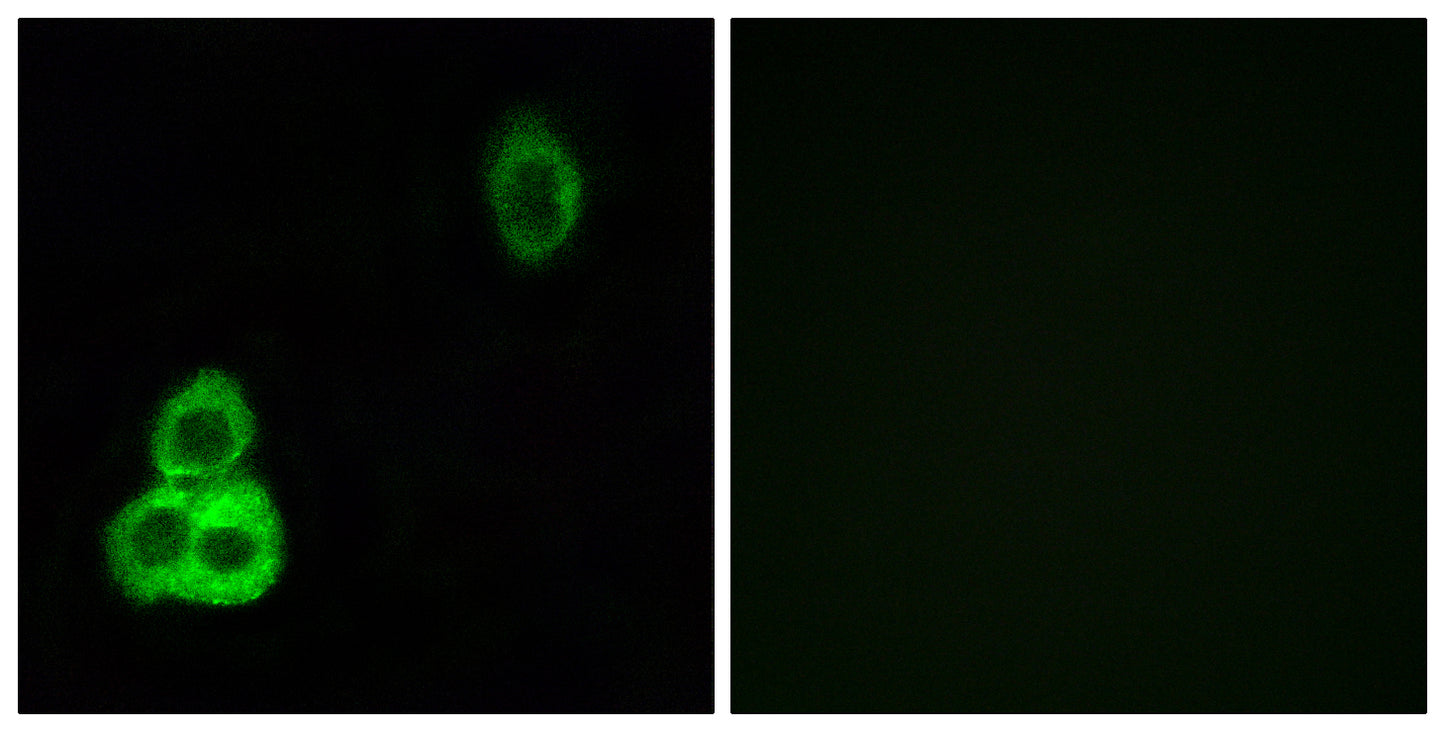 CDHF9 Rabbit Polyclonal Antibody