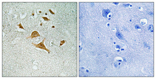 CDK5 Activator-binding C42 Rabbit Polyclonal Antibody