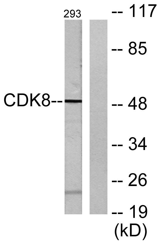 Cdk8 Rabbit Polyclonal Antibody
