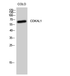 CDKAL1 Rabbit Polyclonal Antibody