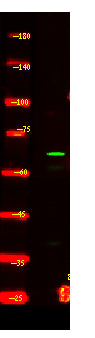 CEA20 Rabbit Polyclonal Antibody