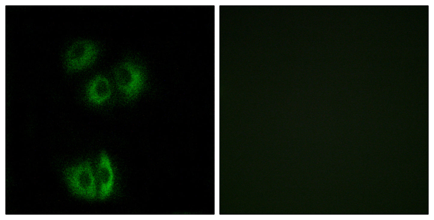 CELSR3 Rabbit Polyclonal Antibody
