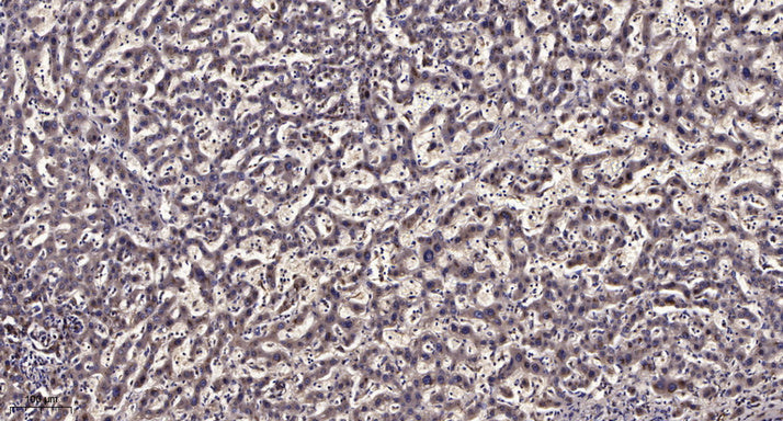 CEP41 Rabbit Polyclonal Antibody