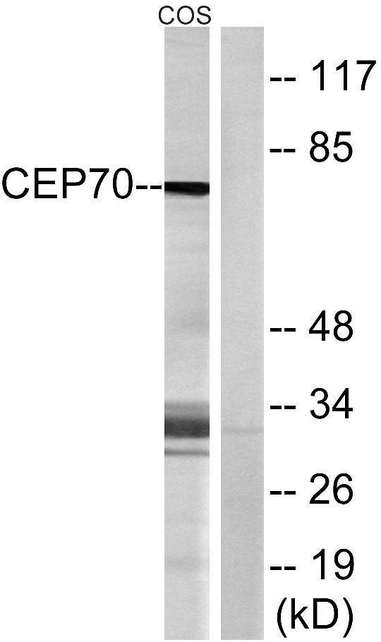 CEP70 Rabbit Polyclonal Antibody
