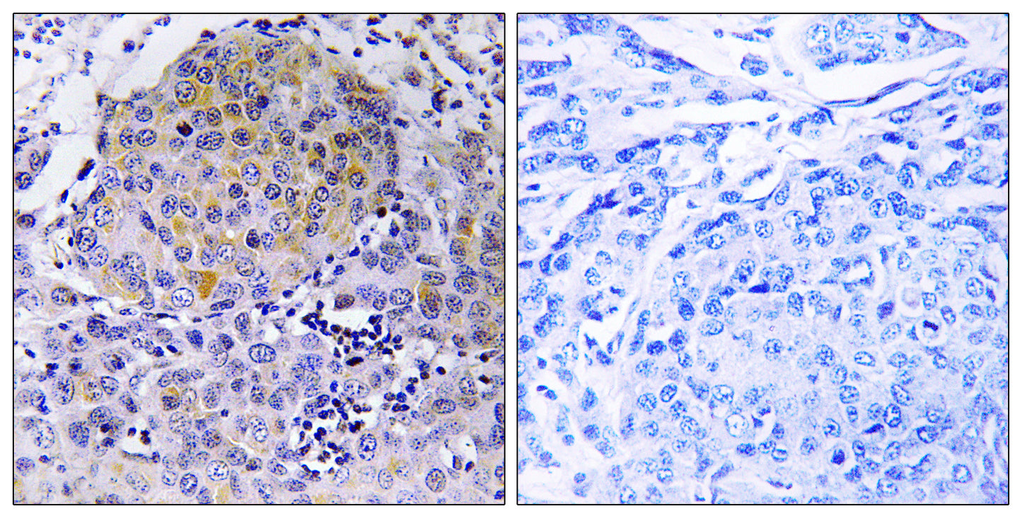 CEP78 Rabbit Polyclonal Antibody