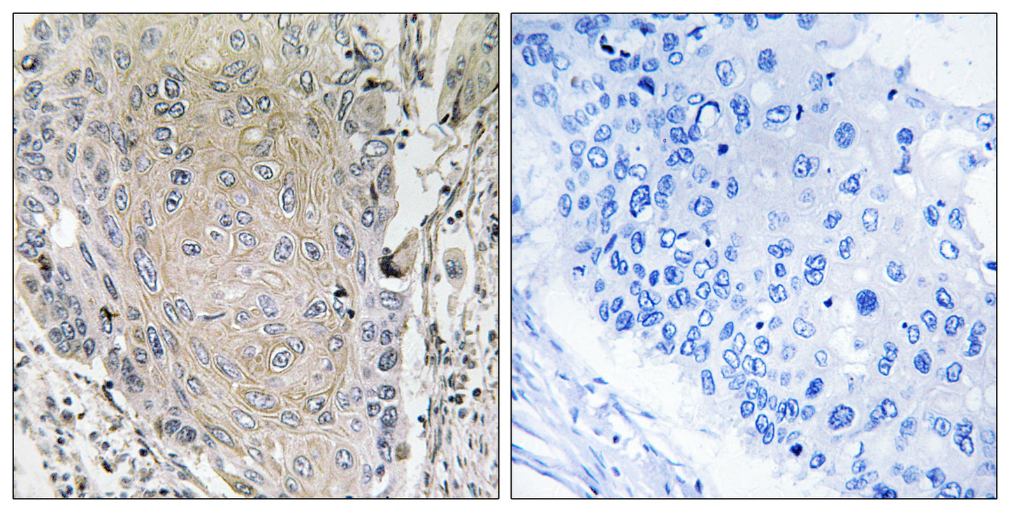 Cerebellin 3 Rabbit Polyclonal Antibody