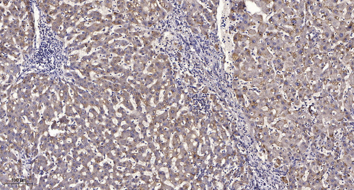 CES2 Rabbit Polyclonal Antibody