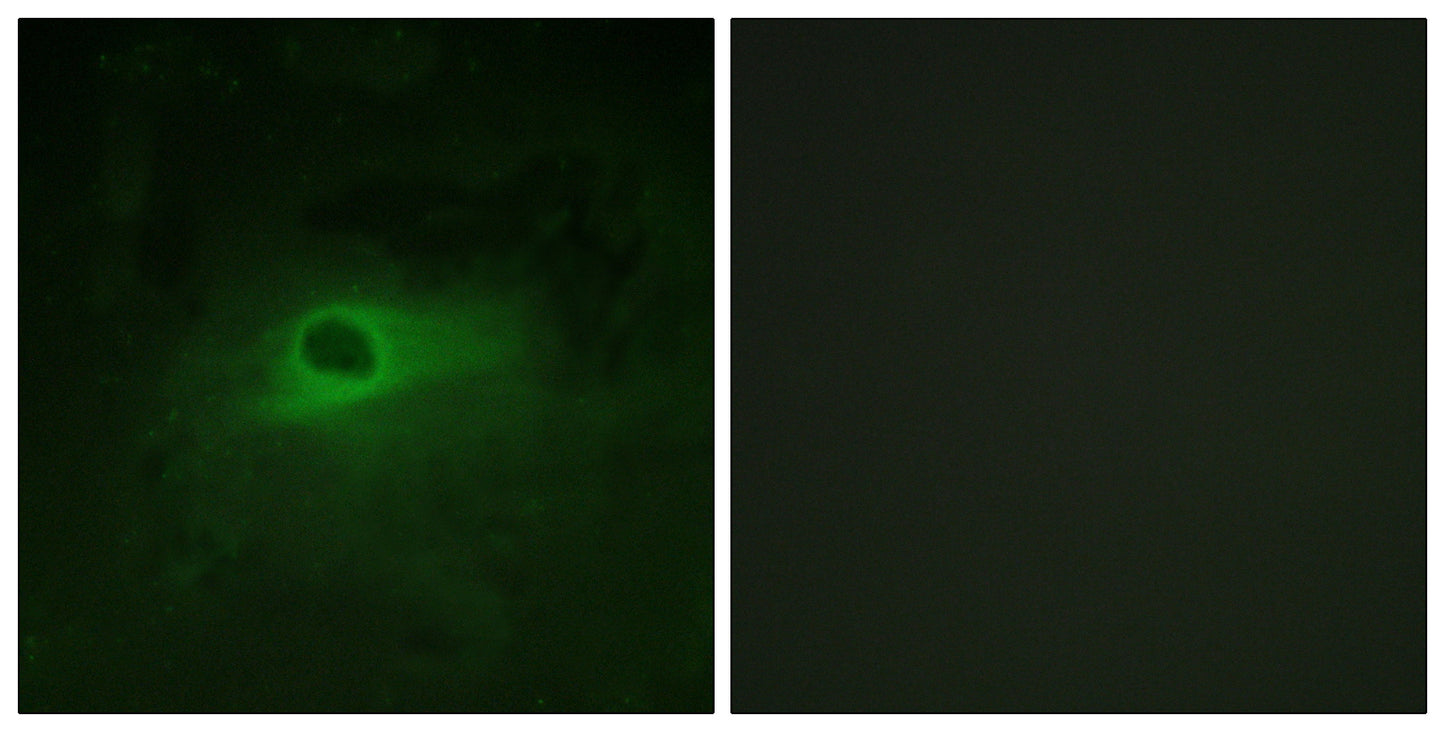 c-Fms Rabbit Polyclonal Antibody