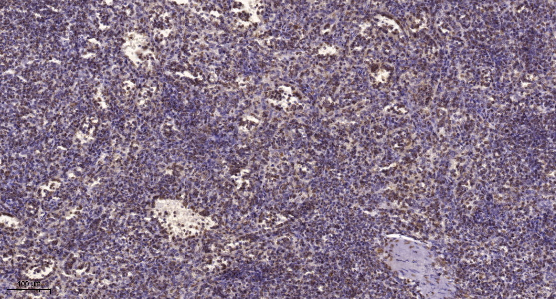 CHD8 Rabbit Polyclonal Antibody