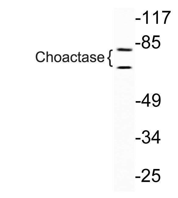 Choactase Rabbit Polyclonal Antibody