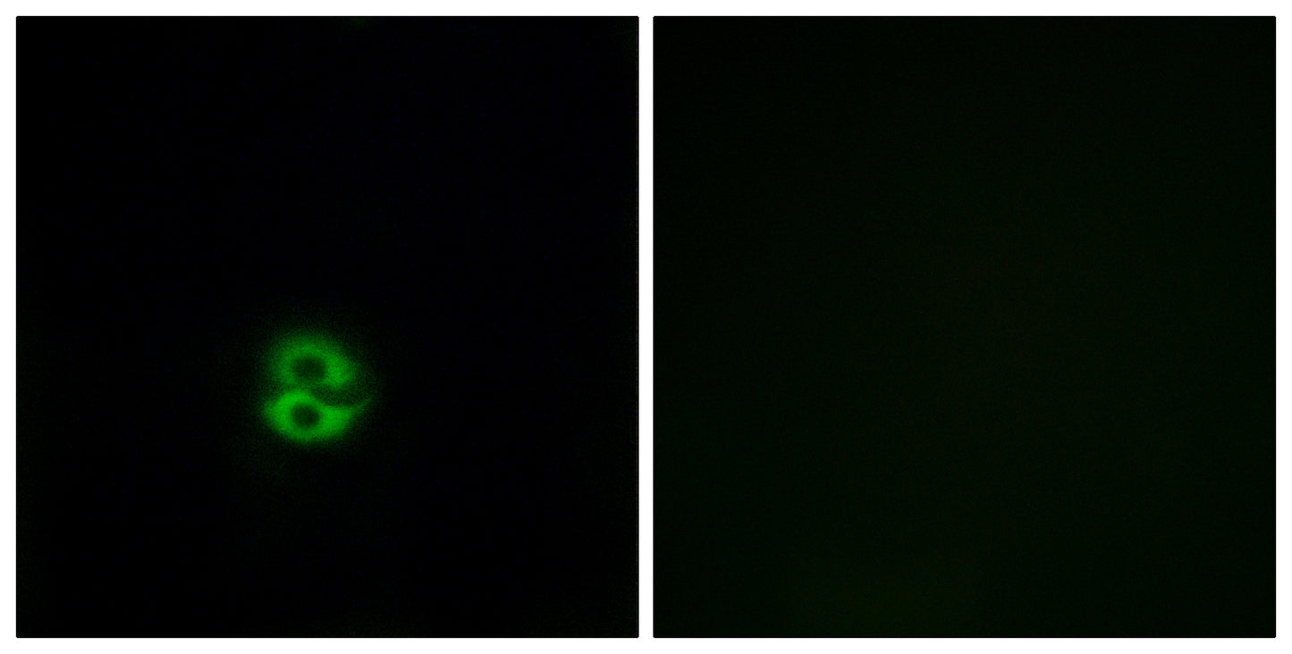 CHST6 Rabbit Polyclonal Antibody