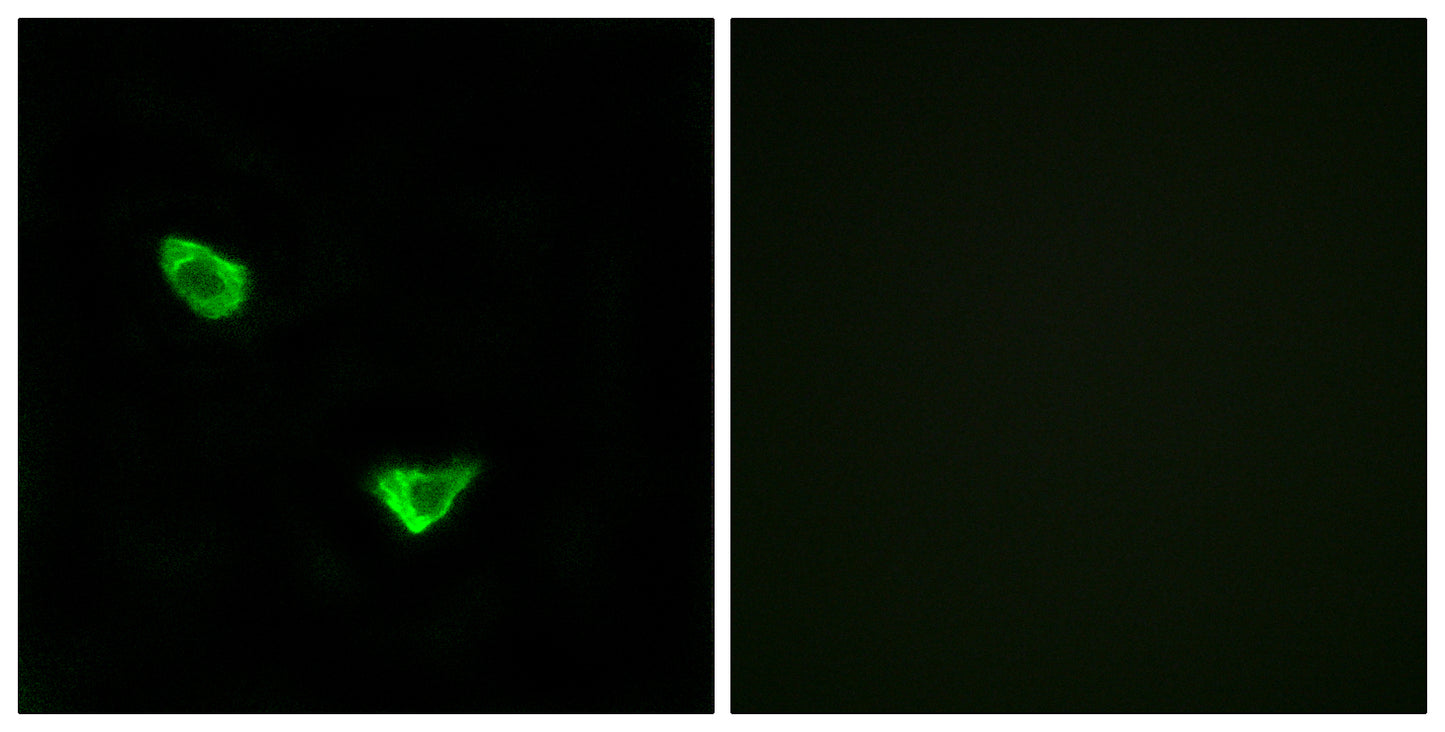 CHSY2 Rabbit Polyclonal Antibody