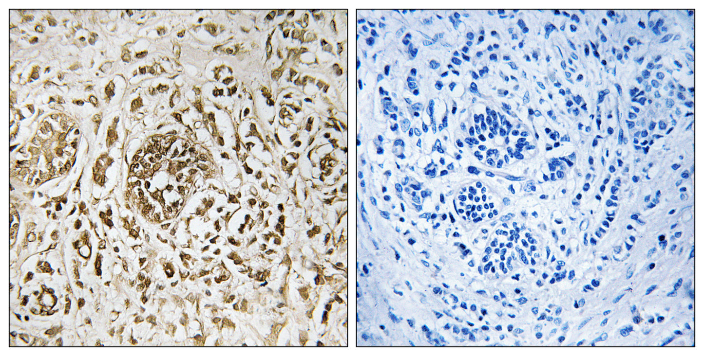 CIB2 Rabbit Polyclonal Antibody