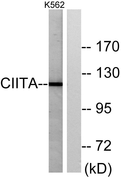 CIITA Rabbit Polyclonal Antibody
