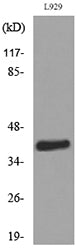 CKR-4 Rabbit Polyclonal Antibody