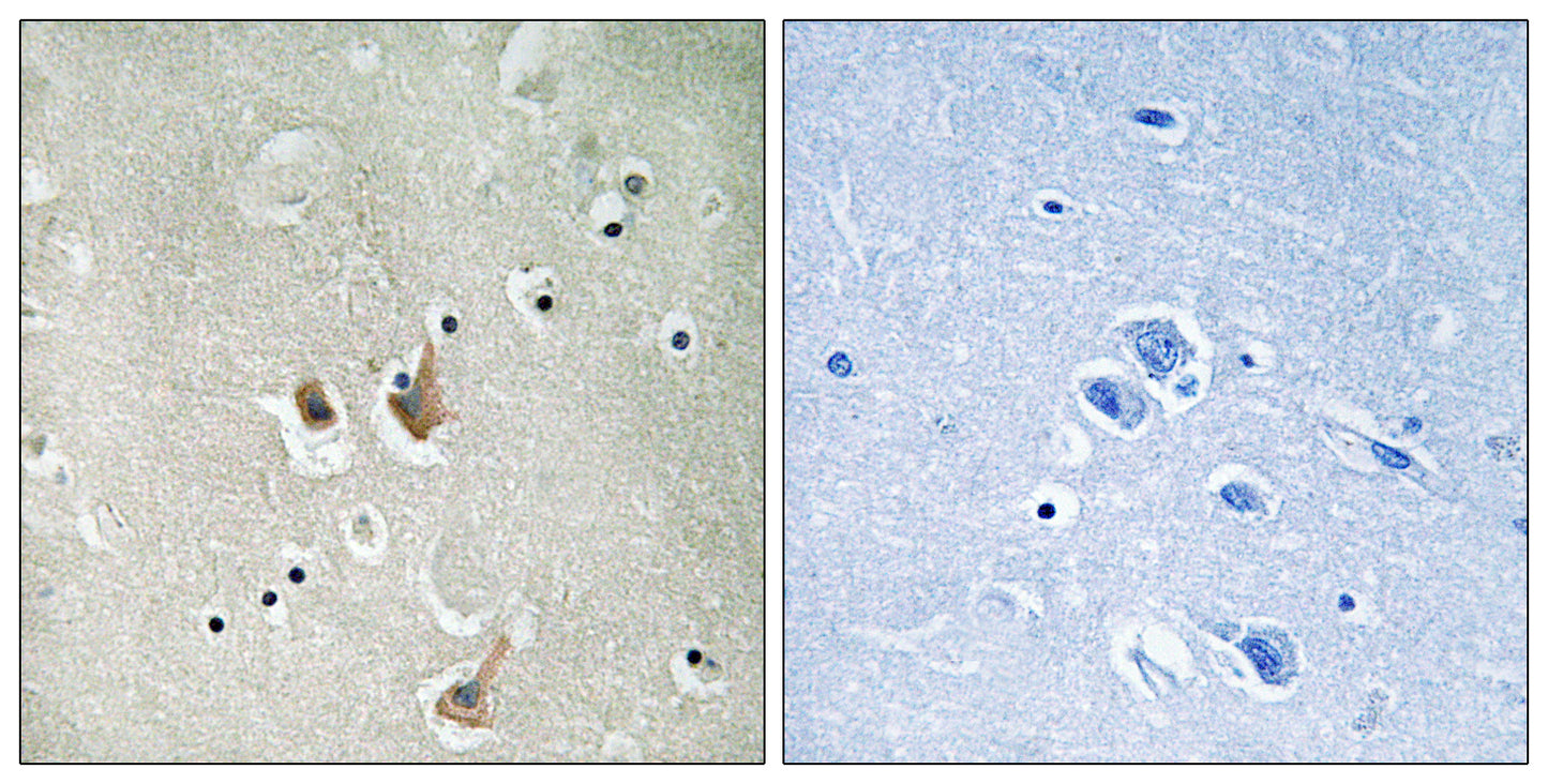 Cks2 Rabbit Polyclonal Antibody