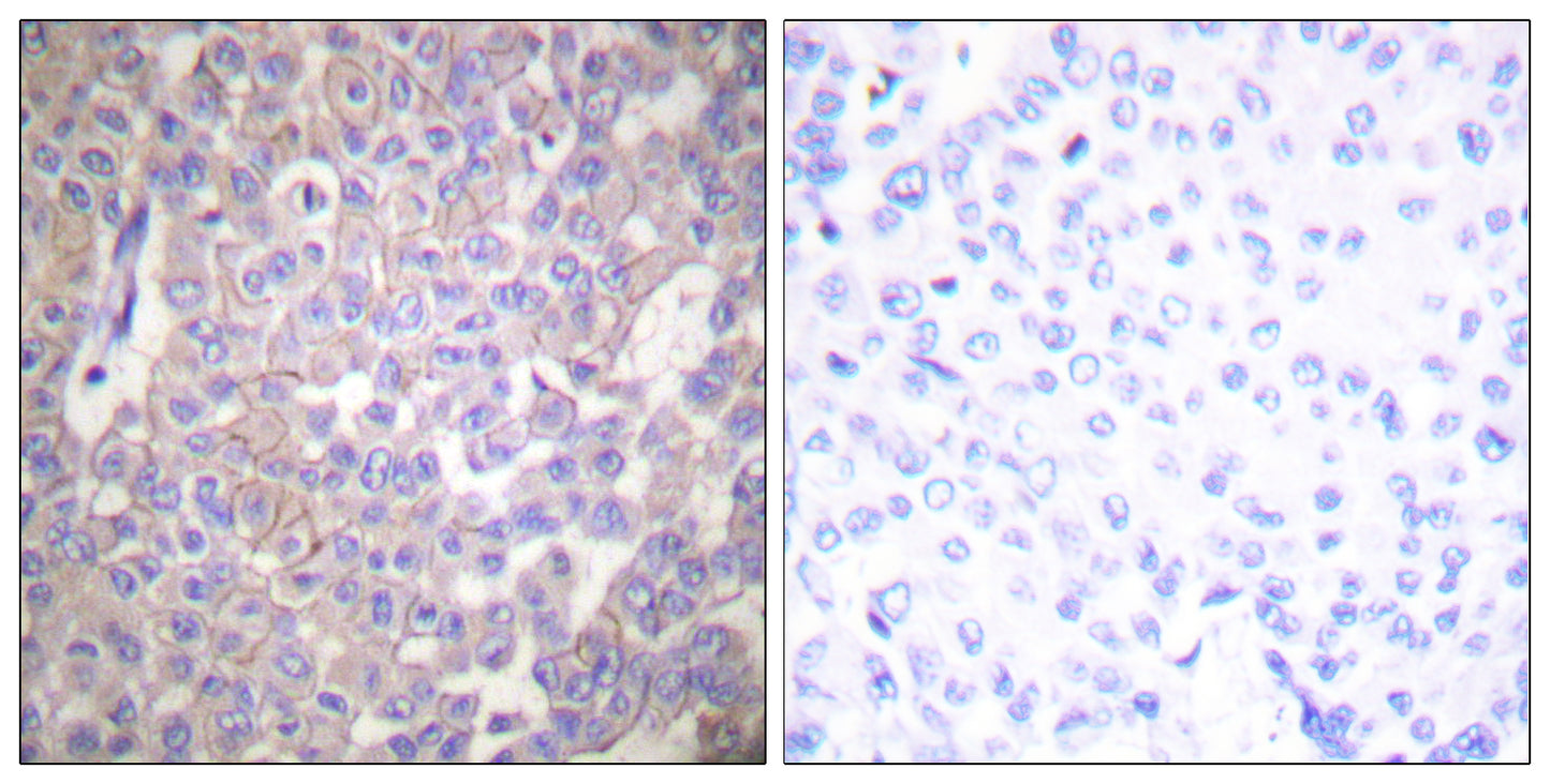 Claudin-2 Rabbit Polyclonal Antibody
