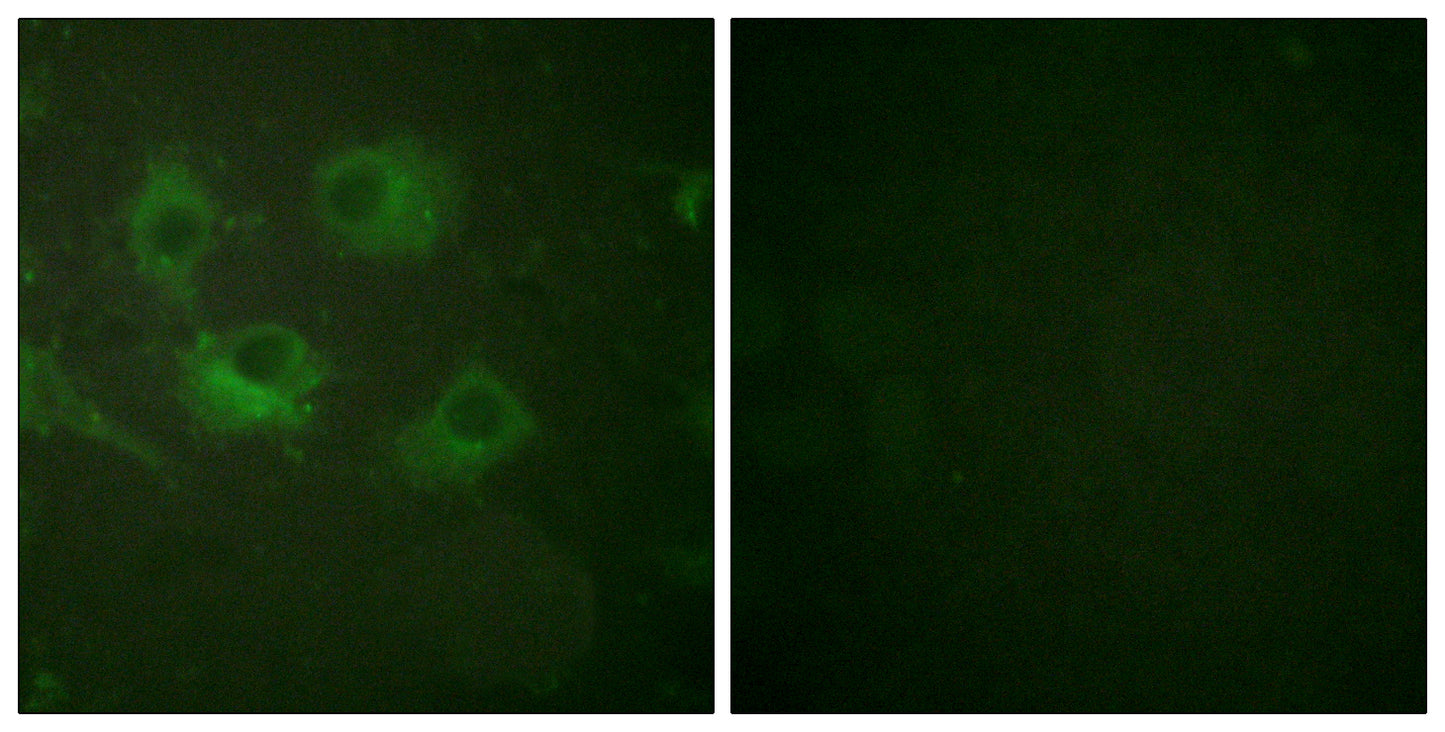 Claudin-3 Rabbit Polyclonal Antibody